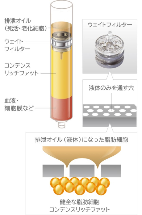 クマ取りと一緒にやる CRFとナノリッチってなに？ | 美容外科