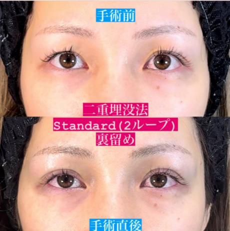 浜松で埋没二重ならPEGASUS CLINIC💓 | 美容外科