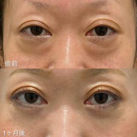 人は見た目が9割！クマがなければ−5歳若返る！ | 美容外科