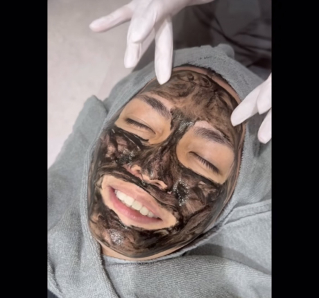 即効性ナンバーワン！ブラックピール✨ | 美容皮膚科