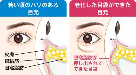 クマの原因って何？💦クマのない人生へ✨ | 美容外科