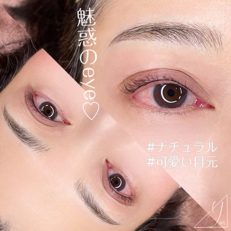 アイラインアートNo.1 | 美容皮膚科