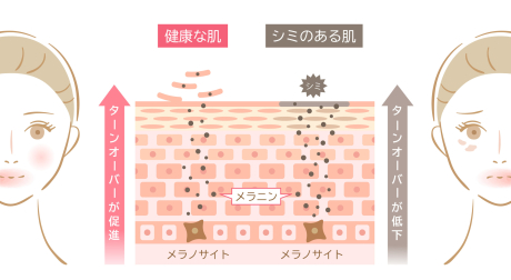 シミ・そばかすは美肌の大敵⚠どうしたら美肌になれるの？？？ | 美容習慣
