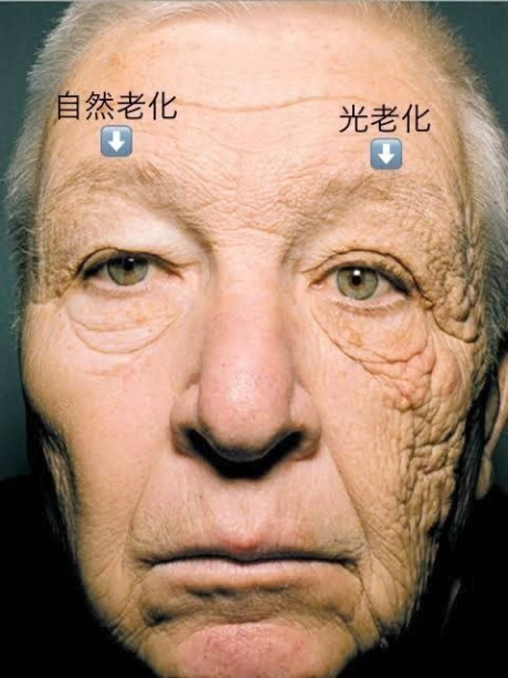 シミ・しわ・たるみの原因は8割これ！ | 美容習慣