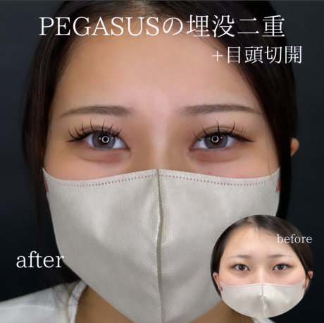 10代女性