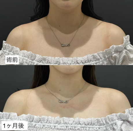 肩こりとはさよならしたい方必見💡 | 美容皮膚科
