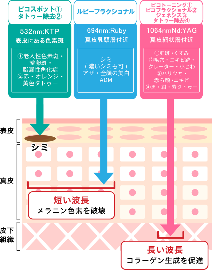 ★ピコレーザーの特徴