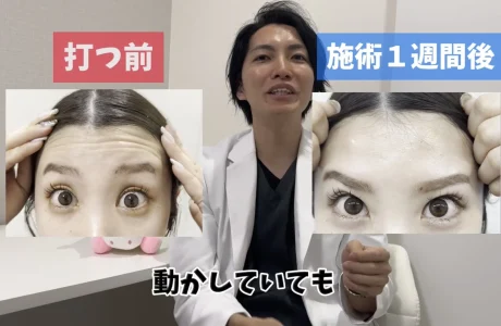 Pegasus ペガサス 美容機器 ※千葉県成田市まで取りに来られる方のみ Pegasus ペガサス 美容機器 ※成田市まで取りに来られる方のみ